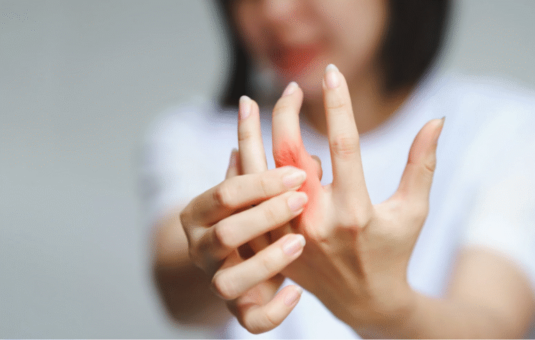 Rheumatoid arthritis
